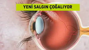 Hem Sayı Hem De Şiddeti Artan Bu Hastalık, 7'den 70'e Herkesi Kapsıyor!